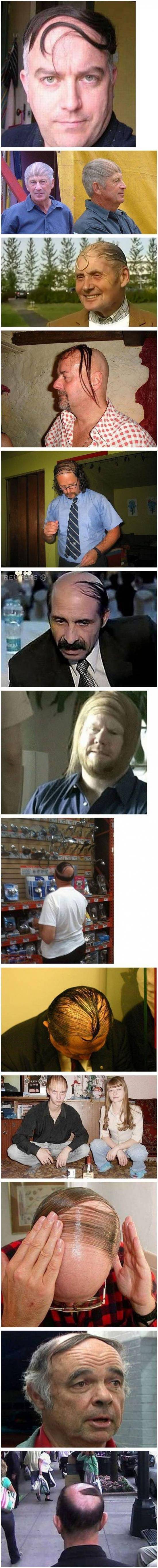 At some point, you just gotta accept that you're going bald.