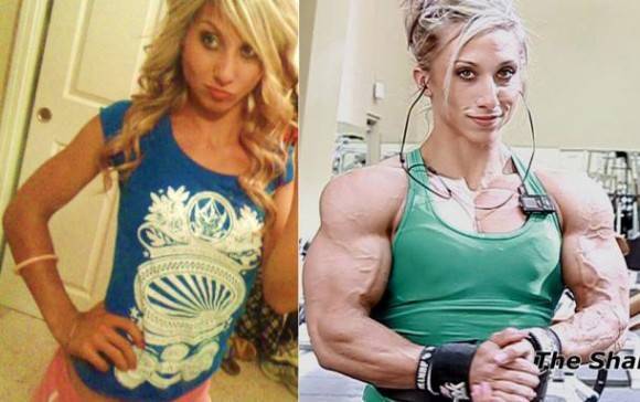 startling before and after of a woman on steroids
