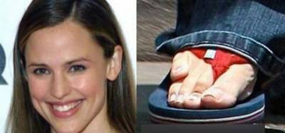 Body defects in celebrities you didn't know
