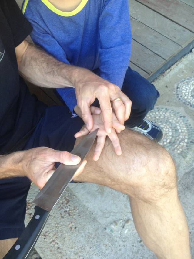 My dad, a safety engineer, taking a splinter out my little brothers hand... the safest way possible.