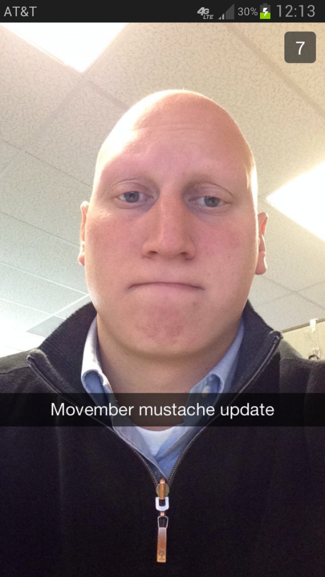 My friend has Alopecia, this is his Movember mustache update.