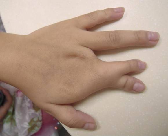 The Sign Of A Compulsive Liar.