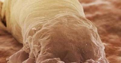 Horrifying pictures of mites, worms and insects taken under a microscope.