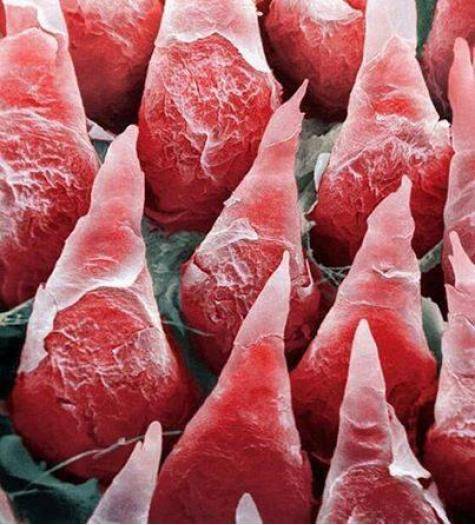 This is the microscopic image of the human tongue.