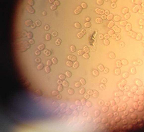 Friend went to examine his blood, found a guy taking a dump in it.