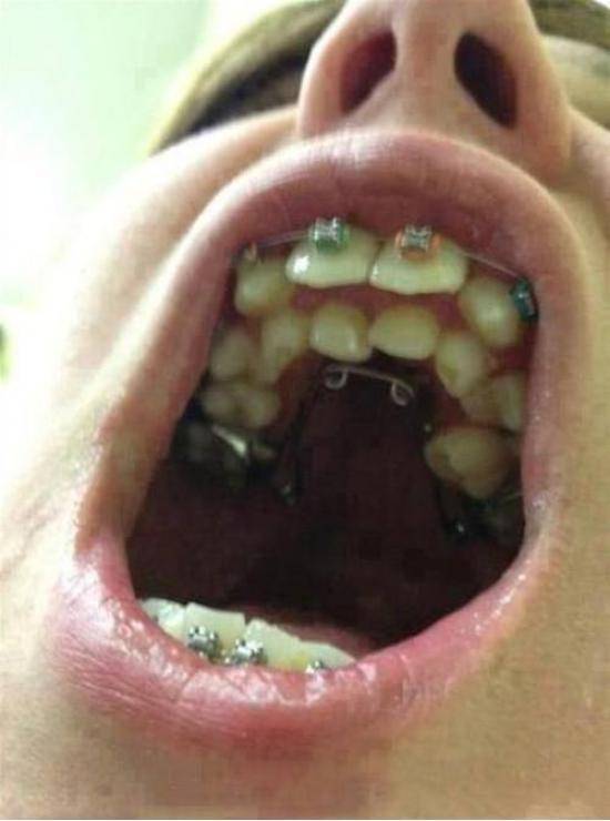Orthodontic wet dream