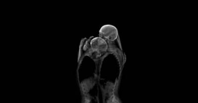 Artist Captures These Really Intimate Moments on X-Ray. 