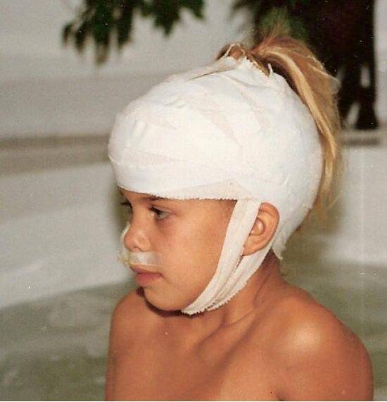 Had an accident as a kid. Mom cut a hole in my head cast for a ponytail that i wore to school – with a bow in it – so people would know i was a girl.