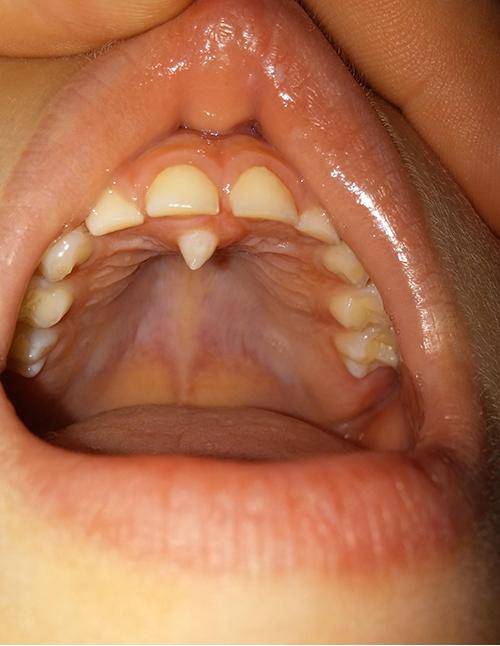 One hiccup and it’ll make your skin flute play an octave higher
