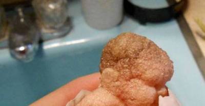 Hatched Human Baby...