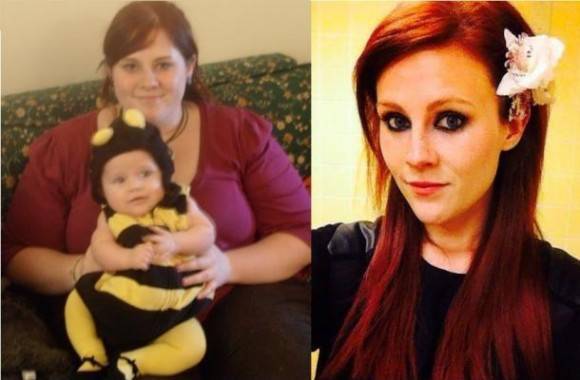 What losing 132 lbs will do to your face.