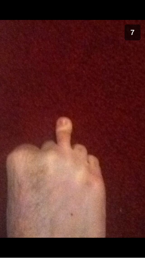 My friend broke both his middle fingers, today I received this
