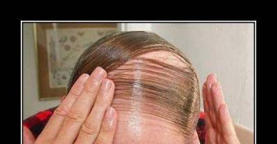 The Most Hilarious And Ugliest Comb Overs