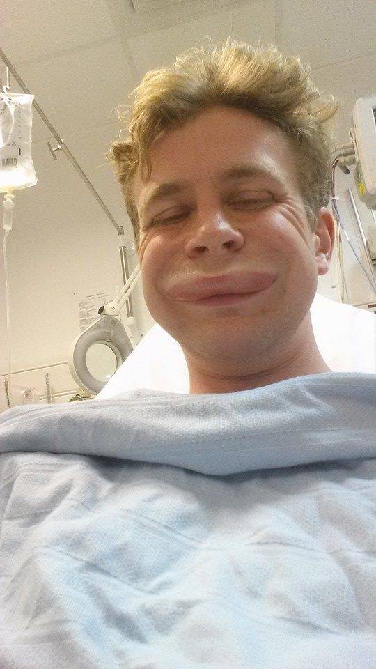 Friend had an allergic reaction and took a hospital selfie