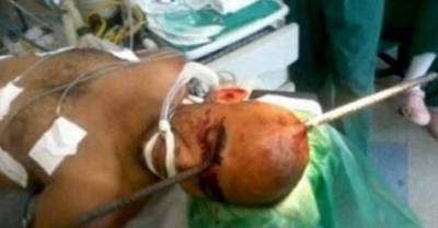 10 Extremely Lucky Survivors Of Deadly And Horrific Accidents