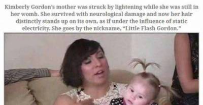 When A Person Gets Struck by Lightning, This Is What Really Happens...