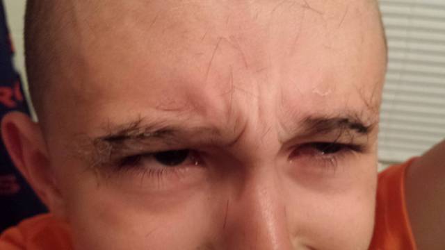 My kid decided to trim his eyebrows. When he cut them too short he decided to cut hair from his head and glue it to his eyebrows. He immediately regretted his decision.