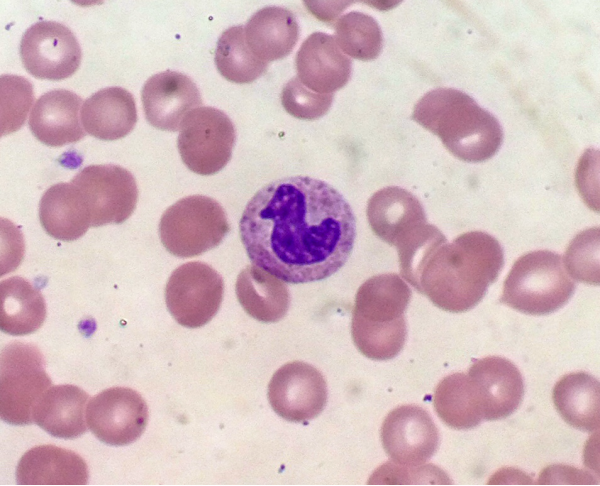 I found a duck in someone’s white blood cell.