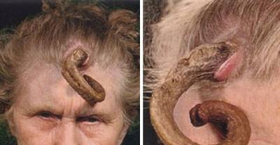 Shocking Bizarre Medical Conditions That Can Tore Your Heart