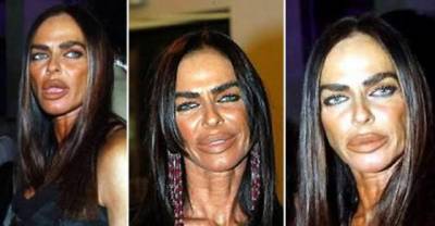 WTF Why Would Women Undergo Plastic Surgery When The Outcome Is Like This?!