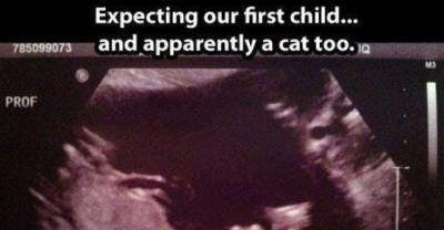14 Funniest Ultrasound Pictures You Ever Seen