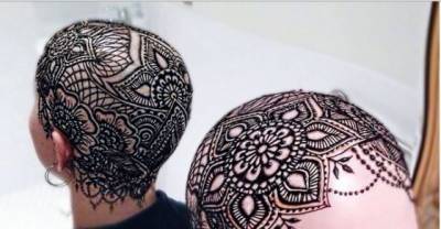 16 Stunning Women Who Show That Being Bald Is Absolutely Beautiful
