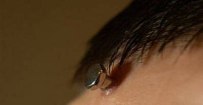 18 Body Piercings That Are Full Of Cringe! (NSFW)