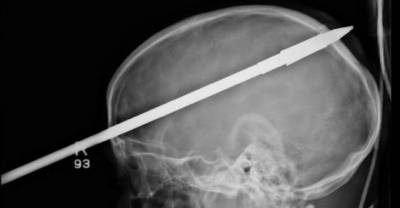 11 More Of The Craziest X-Rays Ever Taken