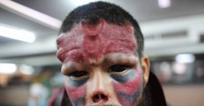 Some Of The Most Ridiculously Extreme Plastic Surgeries Used To Look Like Someone Else