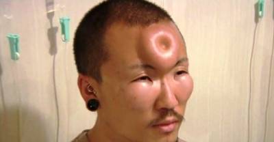 20 Body Modifications That Will Make You Cringe (NSFW)