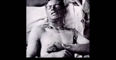10 of the Most Shocking Nazi Experiments
