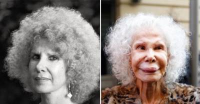 15 Celebrities Whose Plastic Surgeries Went Terribly Wrong