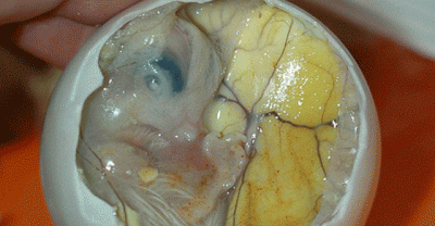 20 Strangest Foods from Around The World #11 is YUCK