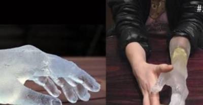The 10 Coolest Prosthetic Limbs You'll Ever See