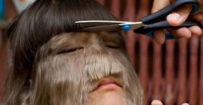 Meet The Worlds Hairiest Girl Lovingly Referred To As Wolf Child.