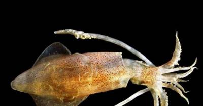 15 Horrifying Things Found Living Inside A Human Body #11 is Dare To Watch it