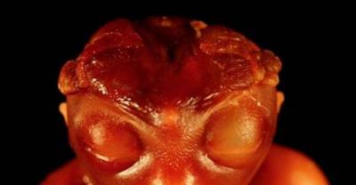 15 Bizarre Genetic Anomalies You Won&rsquo;t Believe Are Real