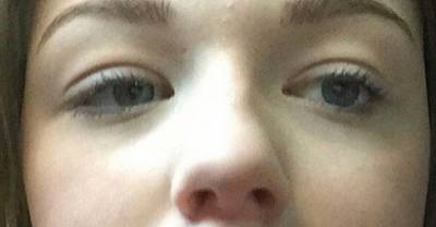 The Kylie Jenner Lip Challenge That Went All Wrong