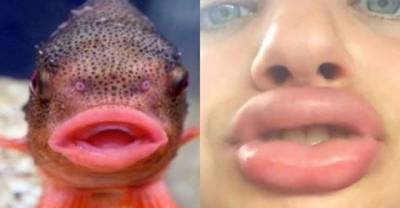 The Kylie Jenner Lip Challenge Continues To Give Girls Fish Lips