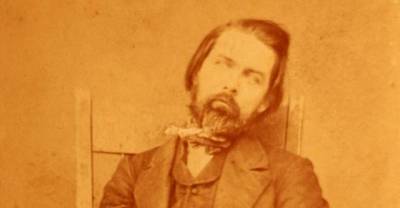 10 Terrible Things Done To The Human Body But Would You Have To Die For IT