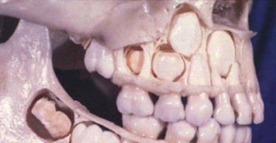 Really Bizarre Pics That Will Make You Look Twice!