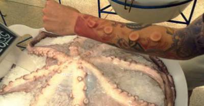 11 Most Bizarre Body Implants You'll Ever See
