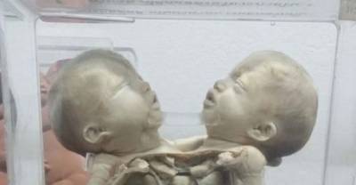 Horrifying Things At Museum Of Thailand Will Send Shivers Down Your Spine