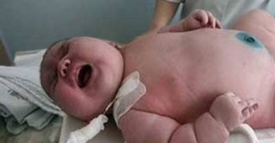 600 Pound Woman Gives Birth To 40 Pound Baby