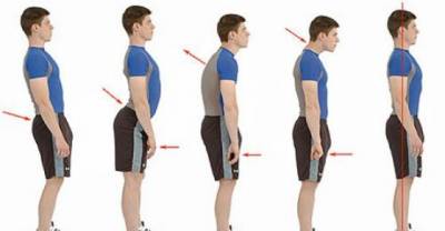 6 Bad Postures Are Ruining Your Health &mdash; How To Correct Them