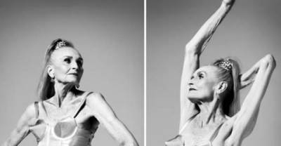 9 Models Who Are Challenging Societal Notions Of Beauty!