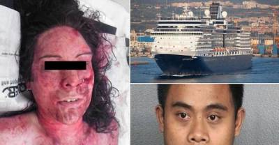 WARNING GRAPHIC CONTENT: Horrific Injuries Suffered By Woman When She Was Assaulted And Almost Thrown Overboard By Attendant On Holland America Cruise