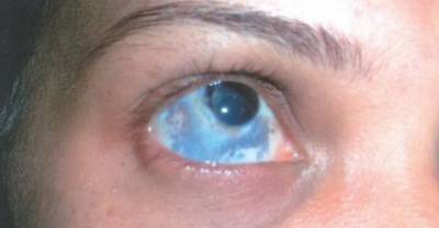 (NSFW) 11 Rare Medical Conditions You&rsquo;ve Never Heard Of (That You Could End Up With)