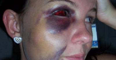 Pregnant Woman Is Abused By Her Boyfriend. What This Stranger Does For Her Is Amazing.