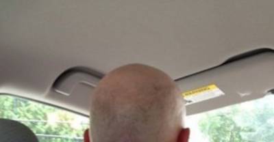 13 Sunbathers Who Should Have Used A Higher SPF